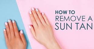 Remedies To Remove Sun Tan