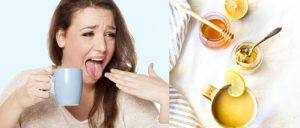 Remedies To Get Rid Of Mouth Ulcers 