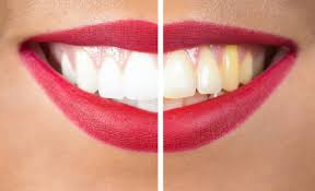 Take care of your teeth and gums like this
