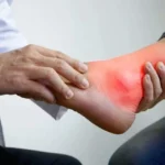 Get Rid of Uric Acid