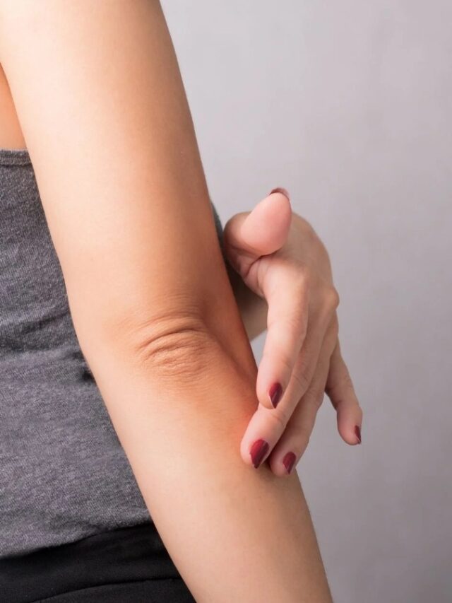 Dark Elbows Home Remedies: कोहनी के जिद्दी कालेपन से पाएं छुटकारा! अपनाएं ये आसान घरेलू नुस्खे