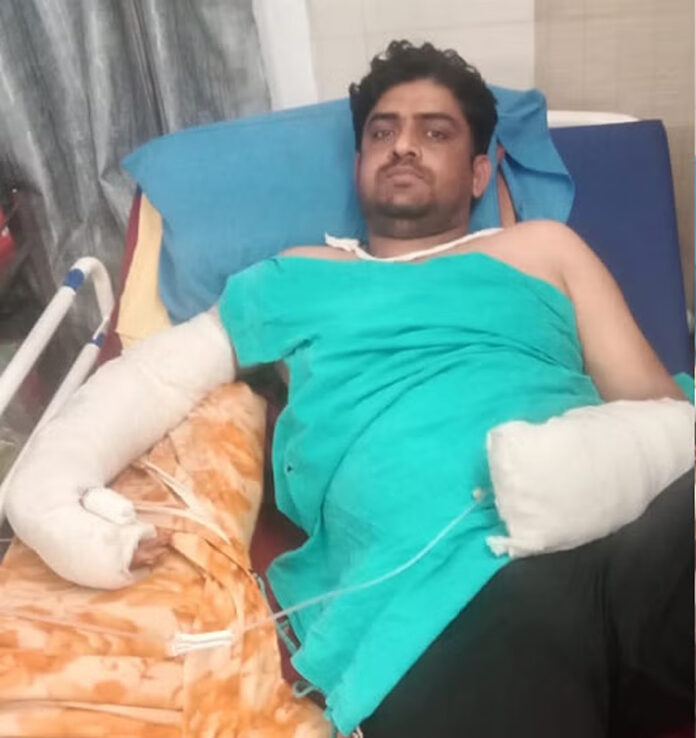 Jind News: जींद में स्कूटी देने से मना करने पर युवक के काटे हाथ