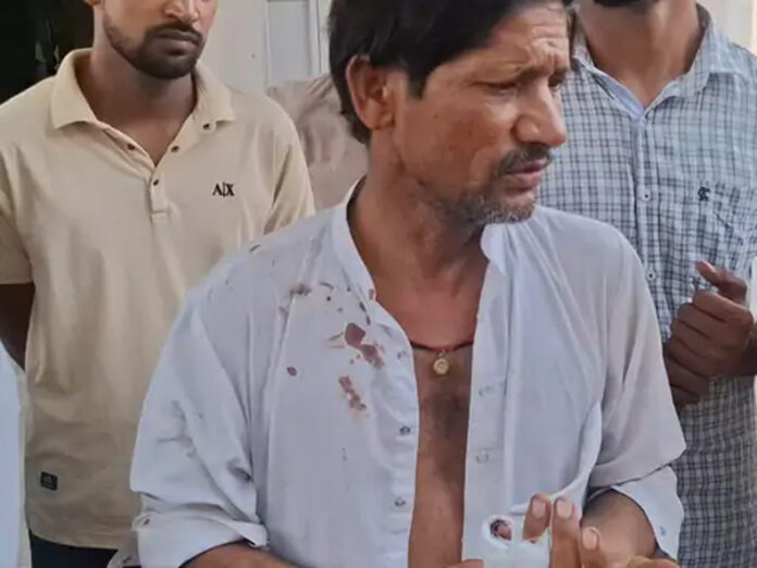 Hisar News: हिसार में सरपंच प्रतिनिधि पर जानलेवा हमला, उंगलियां काटी
