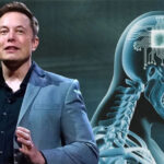 Neuralink Blindsight: एलन मस्क की कंपनी न्यूरालिंक ने बनाया ब्रेन इम्प्लांट डिवाइस