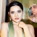 Urfi Javed के चेहरे पर छाई मुसीबत, एलर्जी से सूजा चेहरा, फैंस में बढ़ी चिंता