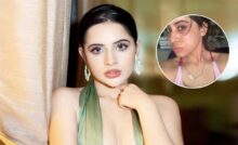 Urfi Javed के चेहरे पर छाई मुसीबत, एलर्जी से सूजा चेहरा, फैंस में बढ़ी चिंता