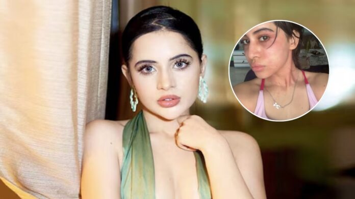 Urfi Javed के चेहरे पर छाई मुसीबत, एलर्जी से सूजा चेहरा, फैंस में बढ़ी चिंता