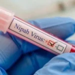 Nipah Virus