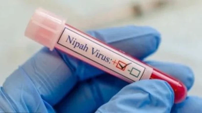 Nipah Virus