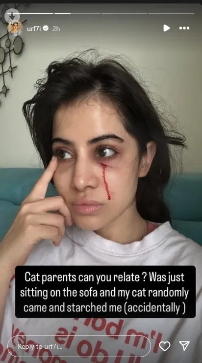 Urfi Javed injured: उर्फी जावेद घायल! चेहरा खून से लथपथ, किसने उन पर हमला किया?