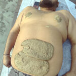 National Naturopathy Day के अवसर पर 'गांधी स्मारक निधि' पट्टीकल्याणा में दी निशुल्क प्राकृतिक एवं पंचकर्म चिकित्सा